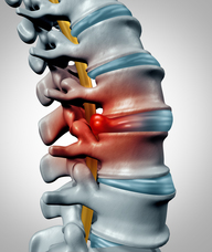 Book an Appointment with Decompression Therapy for Decompression Therapy