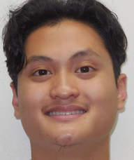 Book an Appointment with Francis Mendoza for Student Acupuncture
