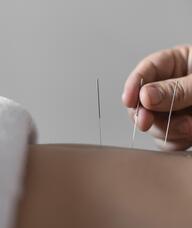 Book an Appointment with Dr. Juan E Torres for Acupuncture